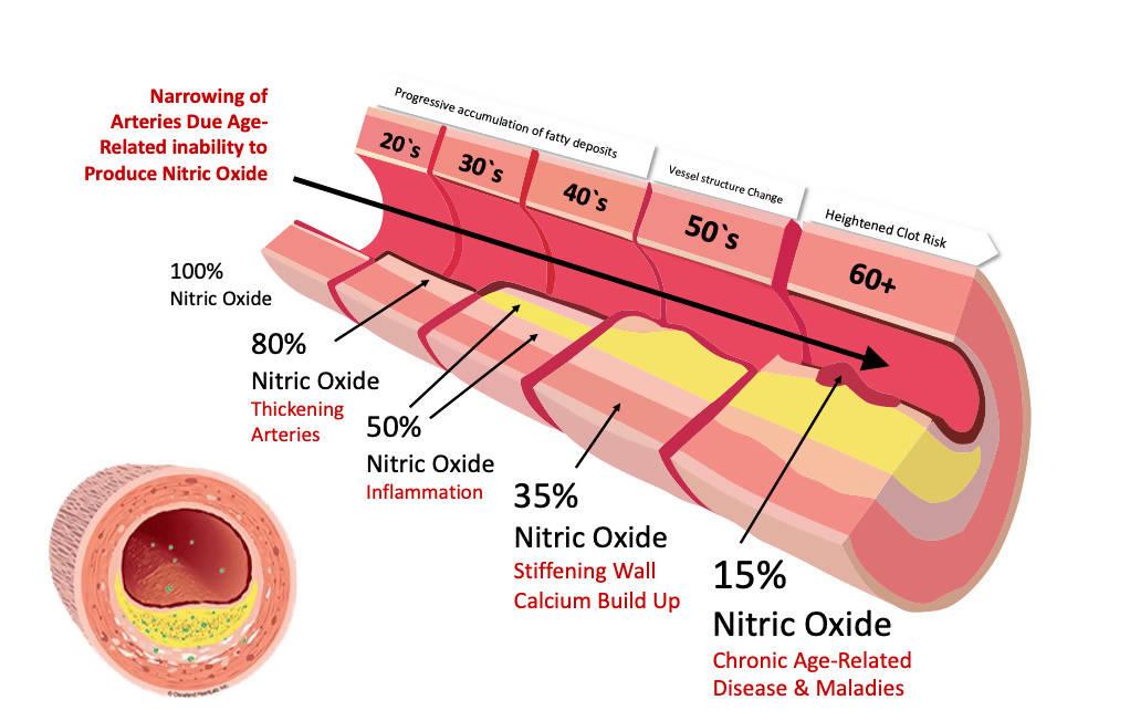 QardioMist™ Nitric Oxide Spray